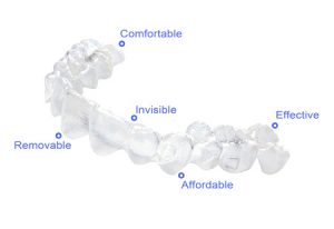 invisable braces